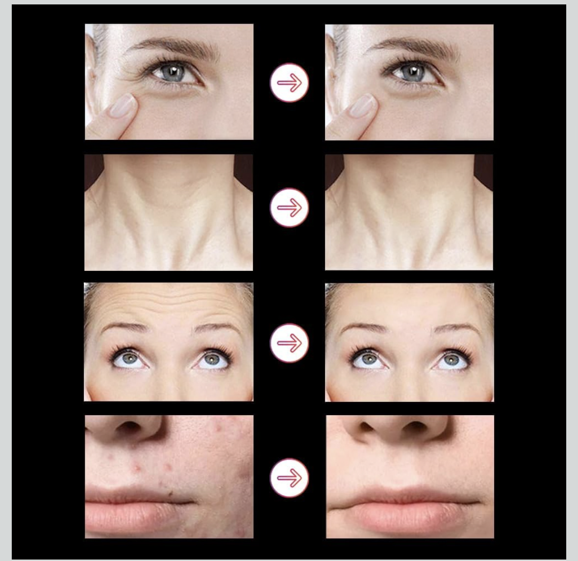 High Frequency Wand Darsonval Handheld Micro-current Device with 6 Different Tubes for Skincare